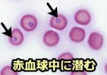 猫の赤血球内におけるバベシアフェリス（Babesia felis）