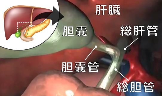 胆嚢と肝臓の接合部