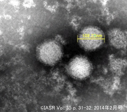 SFTSウイルスの電子顕微鏡写真