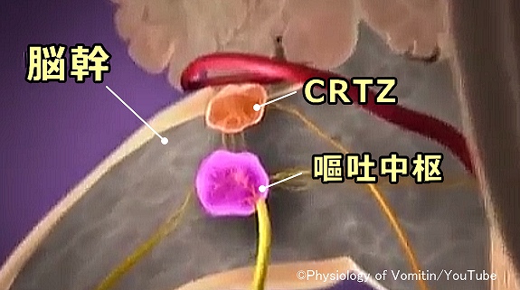 脳幹に位置する化学受容器トリガーゾーン（CRTZ）の模式図