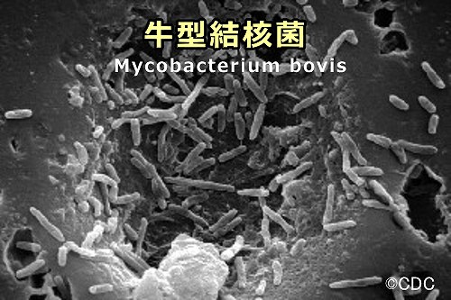牛型結核菌（M.bovis）の電子顕微鏡写真
