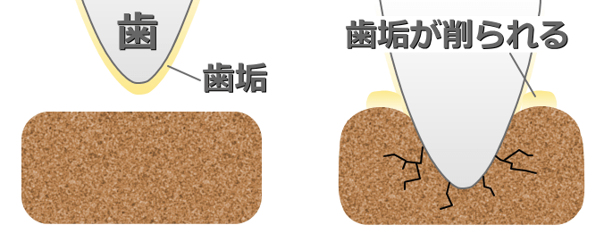 歯の表面に対する機械的な刺激が歯垢を物理的に除去する