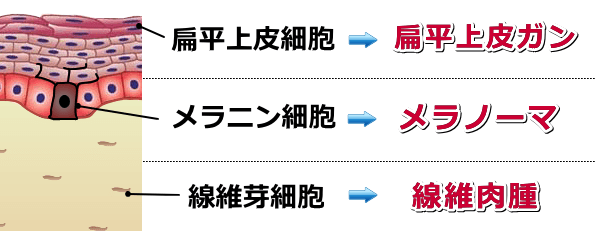 猫のガンの種類～扁平上皮ガン・メラノーマ・線維肉腫