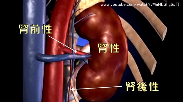 急性じん不全の3大要因~腎性・腎前性・腎後性の模式図