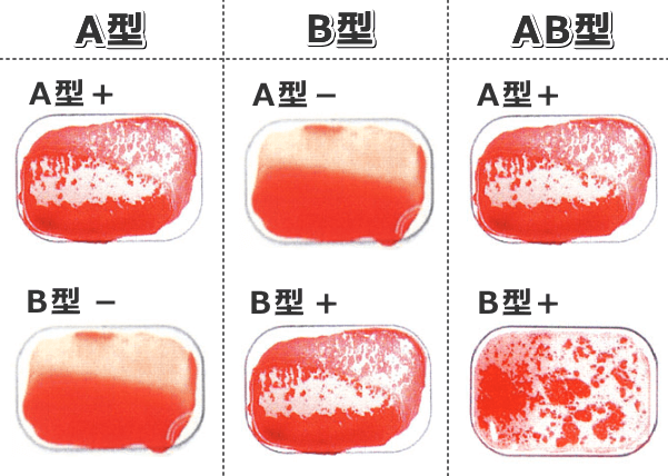 赤血球凝集反応