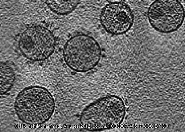 猫免疫不全ウイルス（FIV）の顕微鏡写真