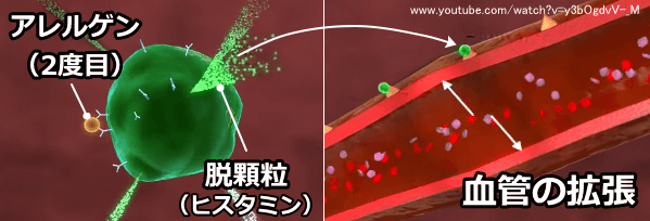 アレルゲンの再侵入~IgE抗体による認識~肥満細胞における脱顆粒
