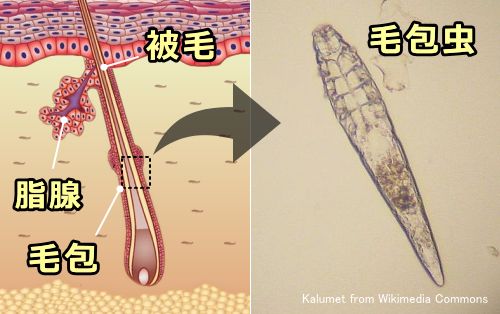 皮膚断面における毛包と皮脂腺の位置と毛包中の外観