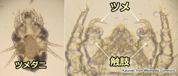 ツメダニ皮膚炎を引き起こすツメダニの顕微鏡写真