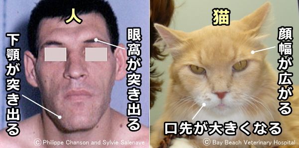人間と猫における先端肥大症の比較写真