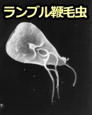 ジアルジア症を引き起こす原虫「ランブル鞭毛虫」