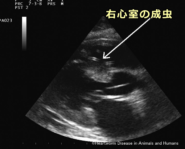 猫の右心室に侵入したフィラリア成虫の心エコー検査像