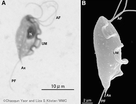 ウシや猫に感染する「トリトリコモナス・フィータス」（Tritrichomonas foetus）