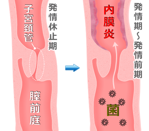 子宮頸管から上行した病原菌が子宮内膜炎を引き起こす