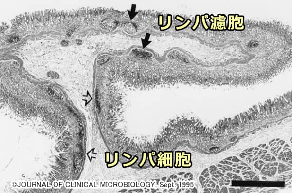 猫の胃粘膜における浸潤したリンパ細胞とリンパ濾胞