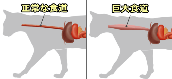 正常な食道と巨大食堂の比較模式図