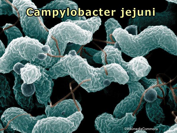 カンピロバクター（jejuni）の電子顕微鏡写真