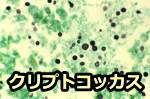 クリプトコックスネオフォルマンス（Cryptococcus neoformans）