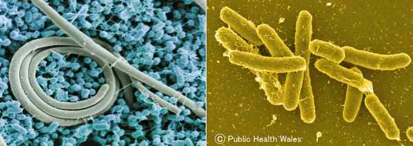 サルモネラ菌の電子顕微鏡画像