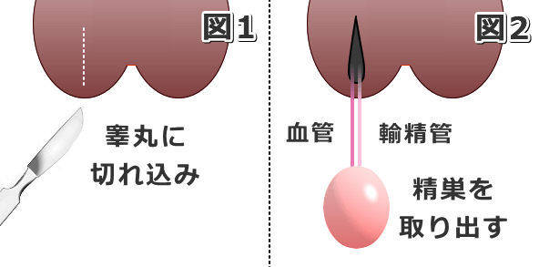 オス 猫 去勢 費用