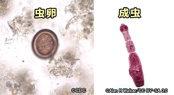 エキノコックスの虫卵と成虫の外観