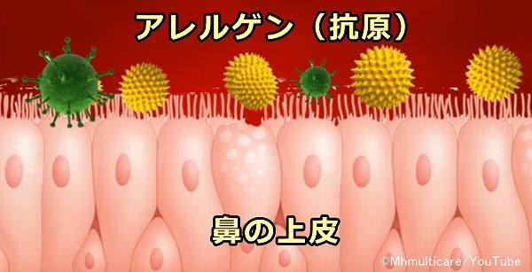 アレルギー性鼻炎の特徴は症状がアレルゲンの特徴に応じて季節性であること