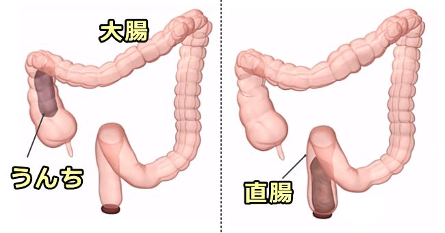 大腸の蠕動運動により排泄物が肛門に移動する