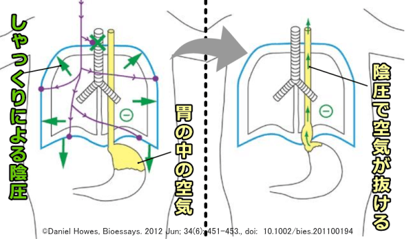 しゃっくり 寝起き