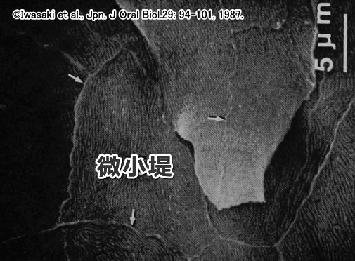 舌体前部の糸状乳頭間部で見られる微小堤(microridge)の顕微鏡写真