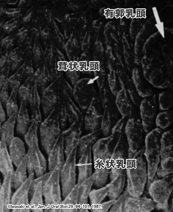 糸状乳頭、茸状乳頭、有郭乳頭の比較写真