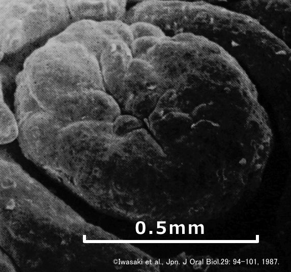 成猫の舌にある有郭乳頭（vallate  papillae）の電子顕微鏡写真