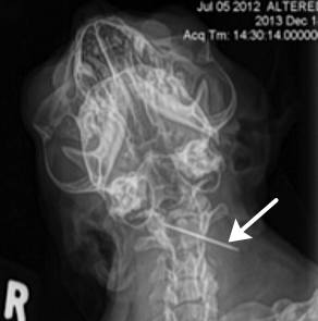 猫が誤飲して脳幹に突き刺さった縫い針
