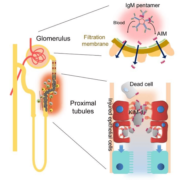 急性腎障害発生時のAIMの役割模式図