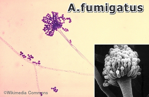 アスペルギルスの一種「A.fumigatus」の顕微鏡写真