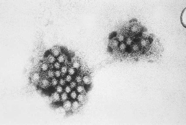 ノロウイルスの顕微鏡写真