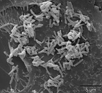 「コリネバクテリウム・ウルセランス」（C. ulcerans）の顕微鏡写真