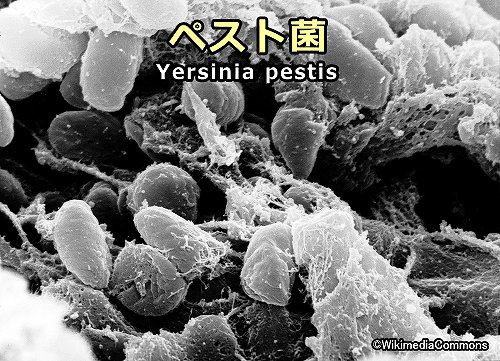 ペスト菌（Yersinia pestis）の電子顕微鏡写真