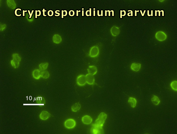 Cryptosporidium parvumの顕微鏡写真