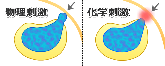 椎間板疾患における近隣神経への物理的刺激と科学的刺激の違い