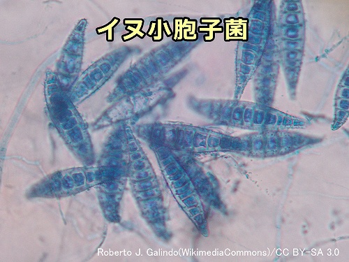 イヌ小胞子菌（Microsporum canis）の顕微鏡写真