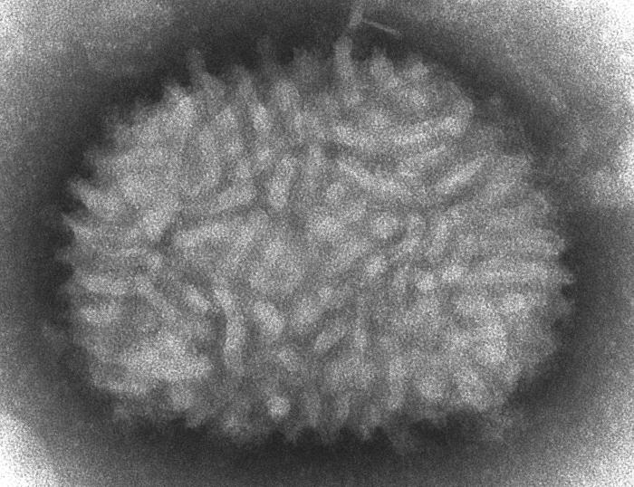 ワクシニアウイルスの電子顕微鏡写真