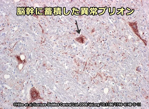 ネコ海綿状脳症（FSE）により脳幹に蓄積した異常プリオン