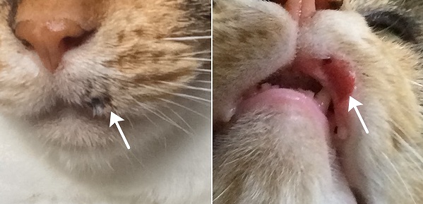 上顎犬歯が上唇を貫通した部位