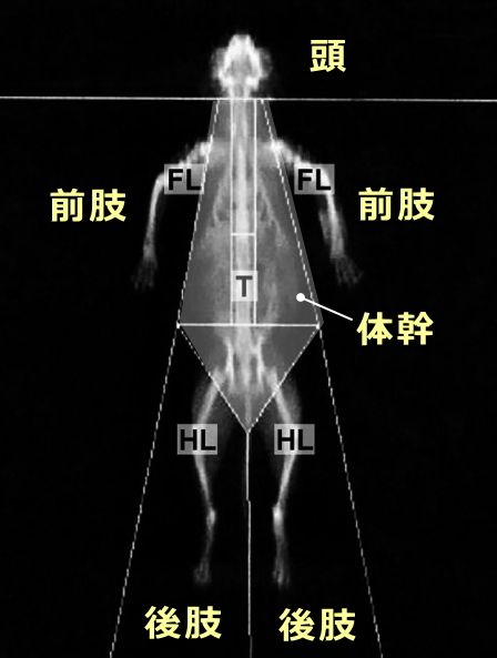 骨量や骨密度を測定するDXA