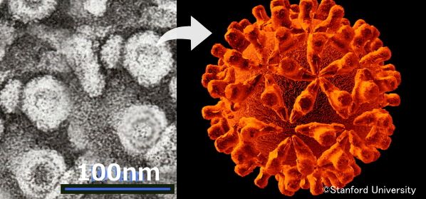 ヘパドナウイルス科に属するB型肝炎ウイルス（HBV）の顕微鏡写真と3D模式図