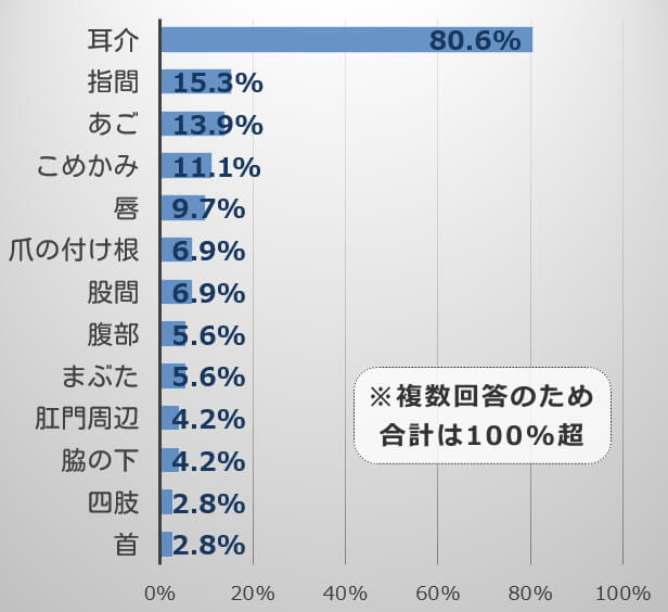 猫の体でツツガムシが好んで寄生する部位