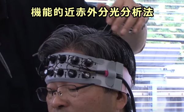 機能的近赤外分光分析法（OEG-SpO2）