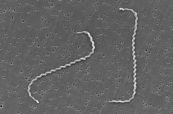 病原性レプトスピラ（Leptospira interrogans）の電子顕微鏡画像