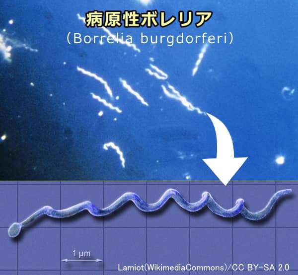 ライム病を引き起こす病原性ボレリアの一種「Borrelia-burgdorferi」の顕微鏡写真