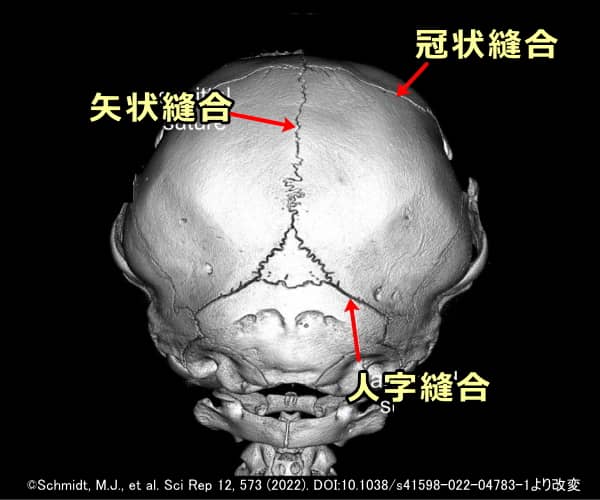 猫の頭蓋骨のCTスキャン画像～後方から見た図